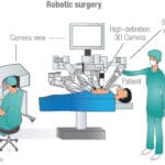 Robotc Surgery