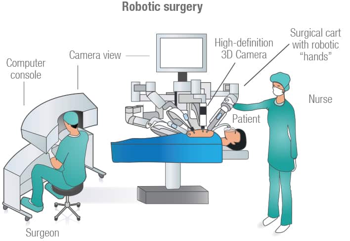 Some Important Facts About Robotic Surgery