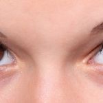 Botox Brow Lift: Cost, Benefits, Side Effects and After Care